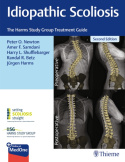 Idiopathic Scoliosis