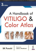 Handbook of Vitiligo & Color Atlas