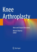 Knee Arthroplasty
