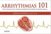 Arrhythmias 101