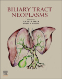 Biliary Tract Neoplasms