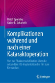 Komplikationen wahrend und nach einer Kataraktoperation