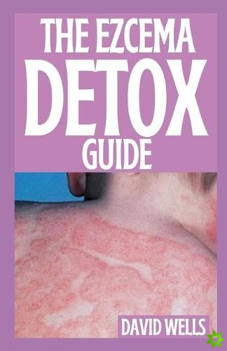 Ezcema Detox Guide
