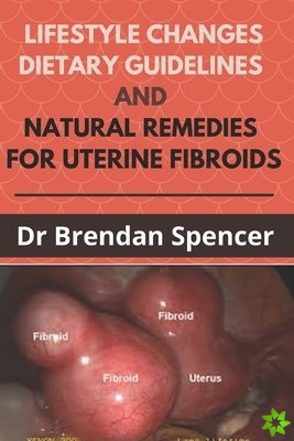 Lifestyle Changes, Dietary Guidelines and Natural Remedies for Uterine Fibroids