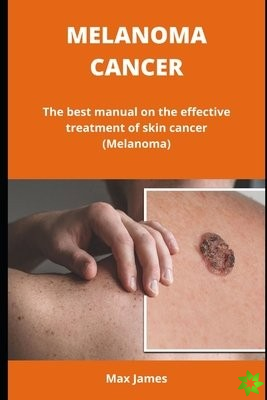 MELANOMA CANCER