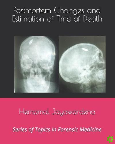 Postmortem Changes and Estimation of Time of Death