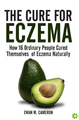 Cure for Eczema