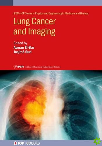 Lung Cancer and Imaging