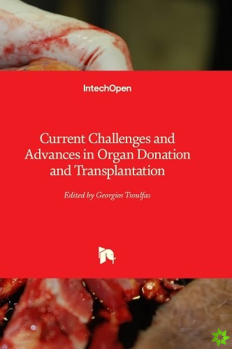 Current Challenges and Advances in Organ Donation and Transplantation