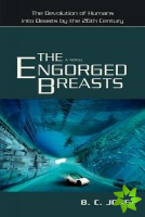 Engorged Breasts