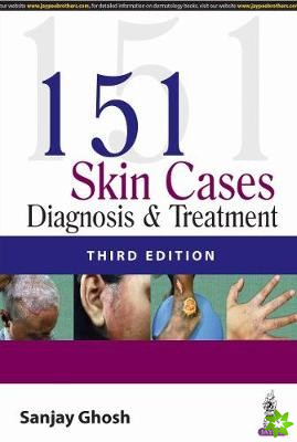 151 Skin Cases