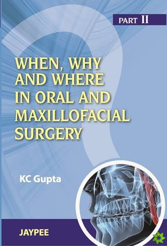 When, Why And Where In Oral And Maxillofacial Surgery: Prep Manual For Undergraduates And Postgraduates Part II
