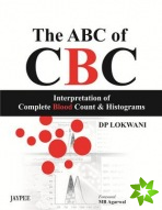 ABC of CBC: Interpretation of Complete Blood Count and Histograms