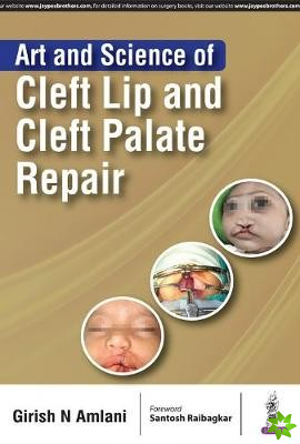 Art and Science of Cleft Lip and Cleft Palate Repair