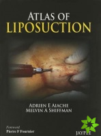 Atlas of Liposuction