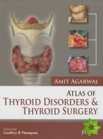 Atlas of Thyroid Disorders and Thyroid Surgery
