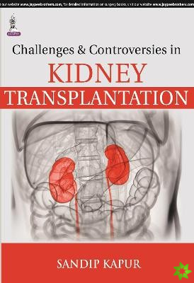 Challenges and Controversies in Kidney Transplantation
