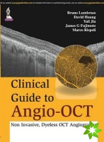 Clinical Guide to Angio-OCT: Non Invasive, Dyeless OCT Angiography