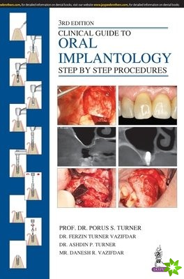 Clinical Guide to Oral Implantology