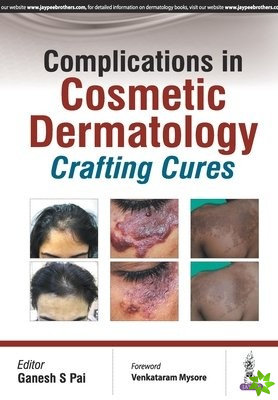 Complications in Cosmetic Dermatology