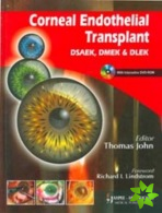 Corneal Endothelial Transplant DSEAK, DMEK and DLEK