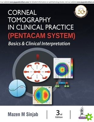 Corneal Tomography in Clinical Practice (Pentacam System)