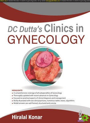DC Dutta's Clinics in Gynecology