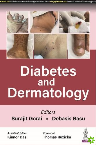 Diabetes and Dermatology
