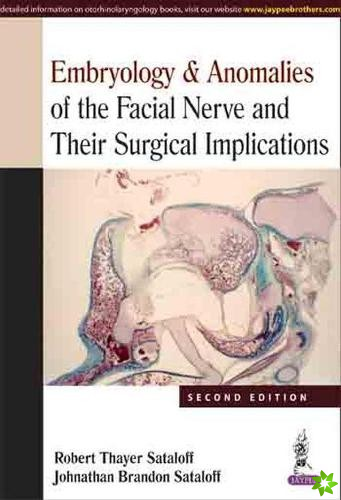 Embryology & Anomalies of the Facial Nerve and Their Surgical Implications