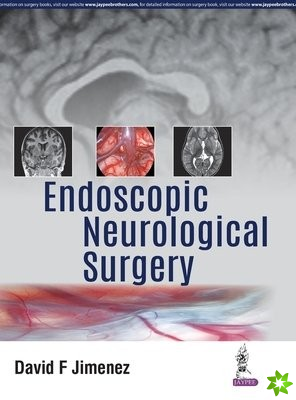 Endoscopic Neurological Surgery