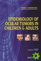 Epidemiology of Ocular Tumors in Children & Adults