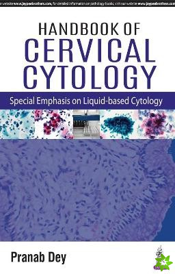 Handbook of Cervical Cytology