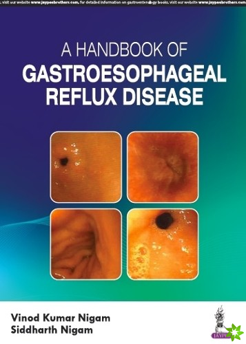 Handbook of Gastroesophageal Reflux Disease (GERD)