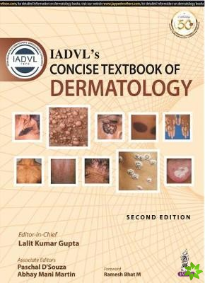 IADVL's Concise Textbook of Dermatology