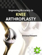 Improving Accuracy in Knee Arthroplasty
