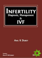 INFERTILITY Diagnosis, Management and IVF