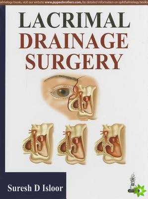 Lacrimal Drainage Surgery