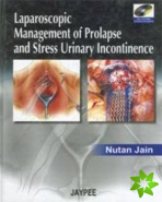 Laparoscopic Management of Prolapse and Stress Urinary Incontinence