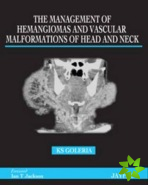Management of Haemangiomas and Vascular Malformations of Head and Neck