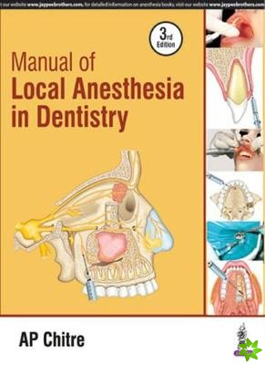 Manual of Local Anaesthesia in Dentistry