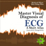 Master Visual Diagnosis of ECG: A Short Atlas (Learn ECG through ECG)