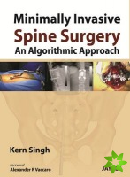 Minimally Invasive Spine Surgery: An Algorithmic Approach