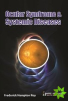 Ocular Syndromes and Systemic Diseases