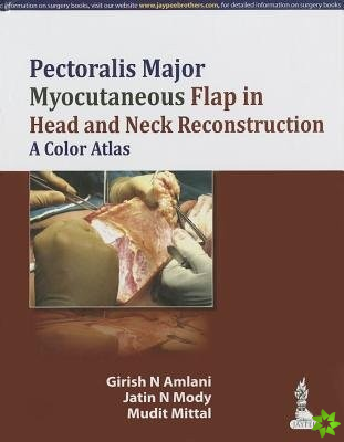 Pectoralis Major Myocutaneous Flap in Head and Neck Reconstruction: A Color Atlas