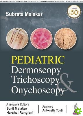 Pediatric Dermoscopy Trichoscopy & Onychoscopy