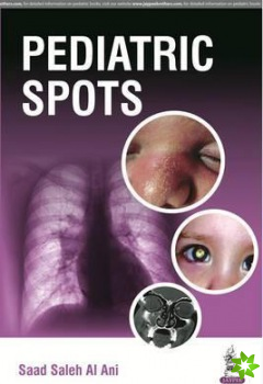 Pediatric Spots