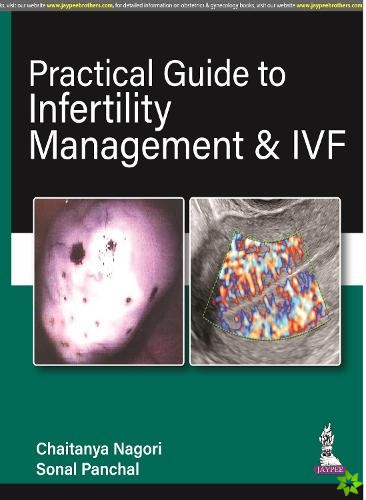 Practical Guide to Infertility Management & IVF