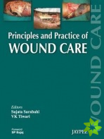 Principles and Practice Of Wound Care