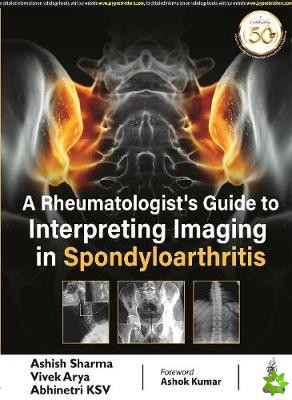 Rheumatologist's Guide to Interpreting Imaging in Spondyloarthritis