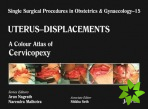 Single Surgical Procedures in Obstetrics and Gynaecology - Volume 15 - UTERUS - DISPLACEMENTS
